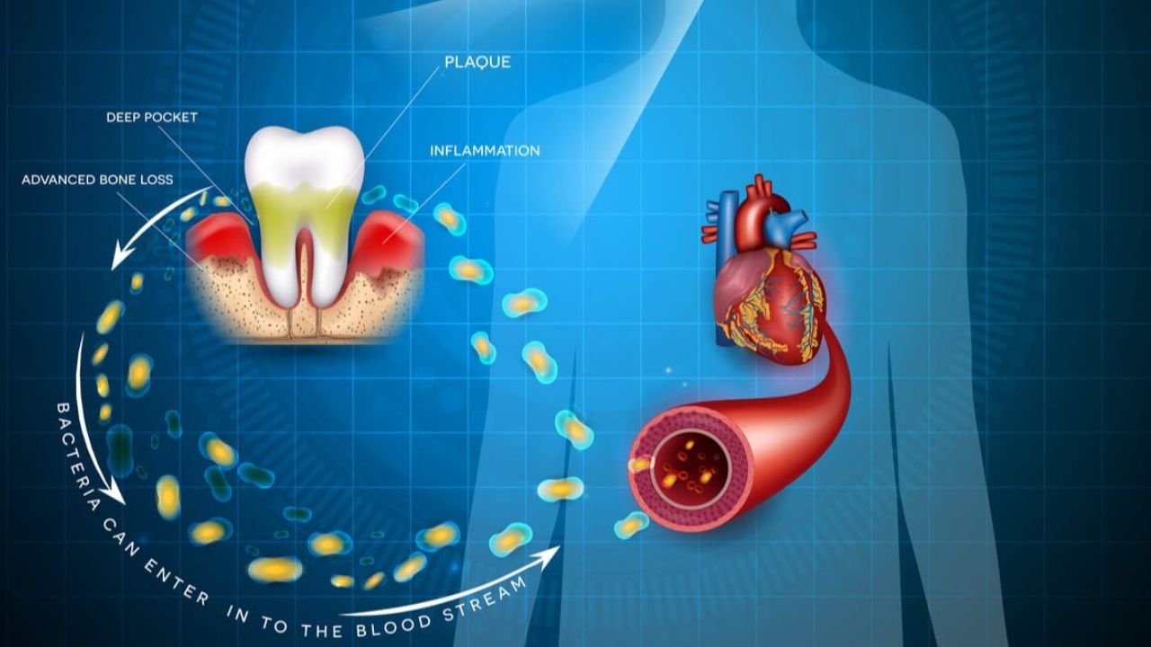 Root Canal And Heart: क्या रूट कैनाल ट्रीटमेंट से हो सकता है दिल का दौरा? जानें सच्चाई