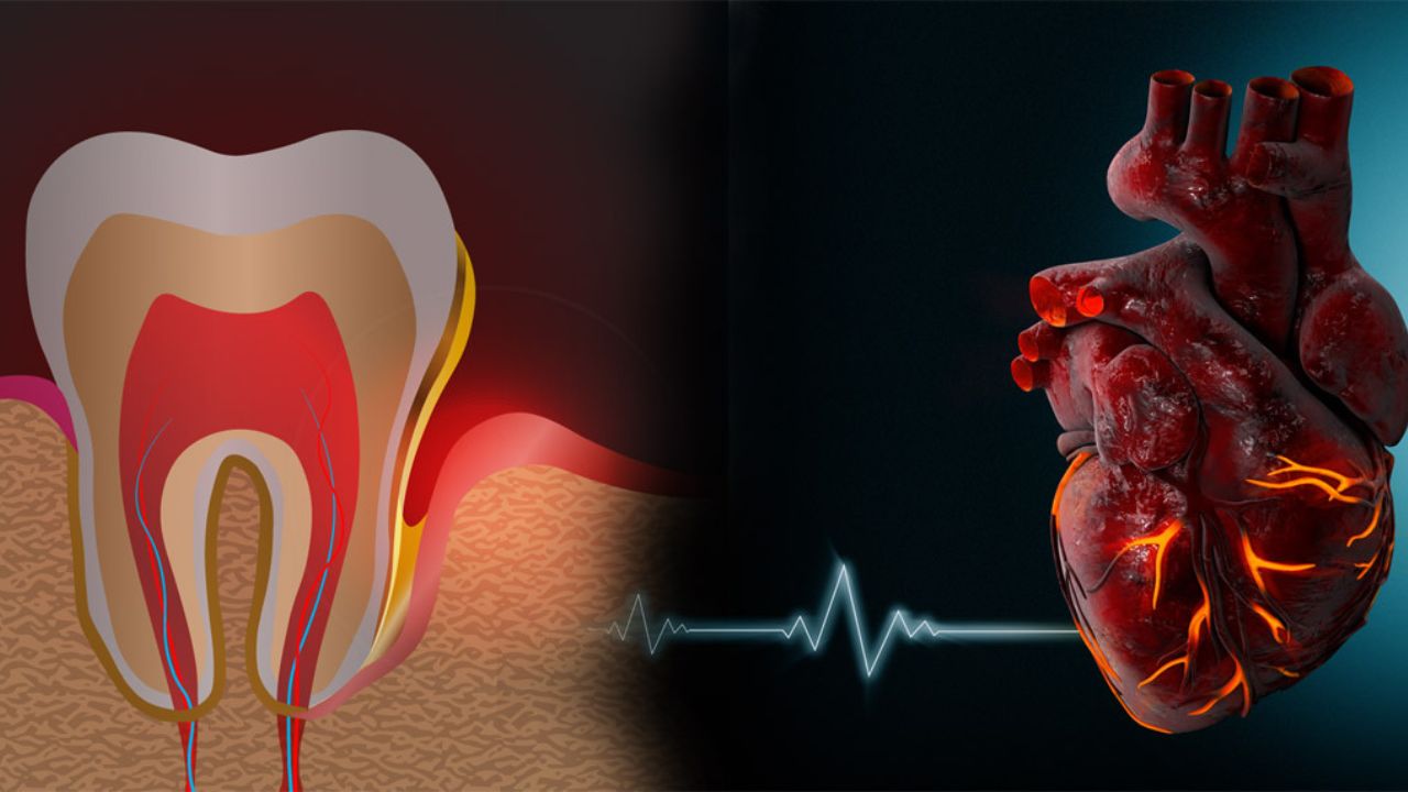 Root Canal And Heart: क्या रूट कैनाल ट्रीटमेंट से हो सकता है दिल का दौरा? जानें सच्चाई