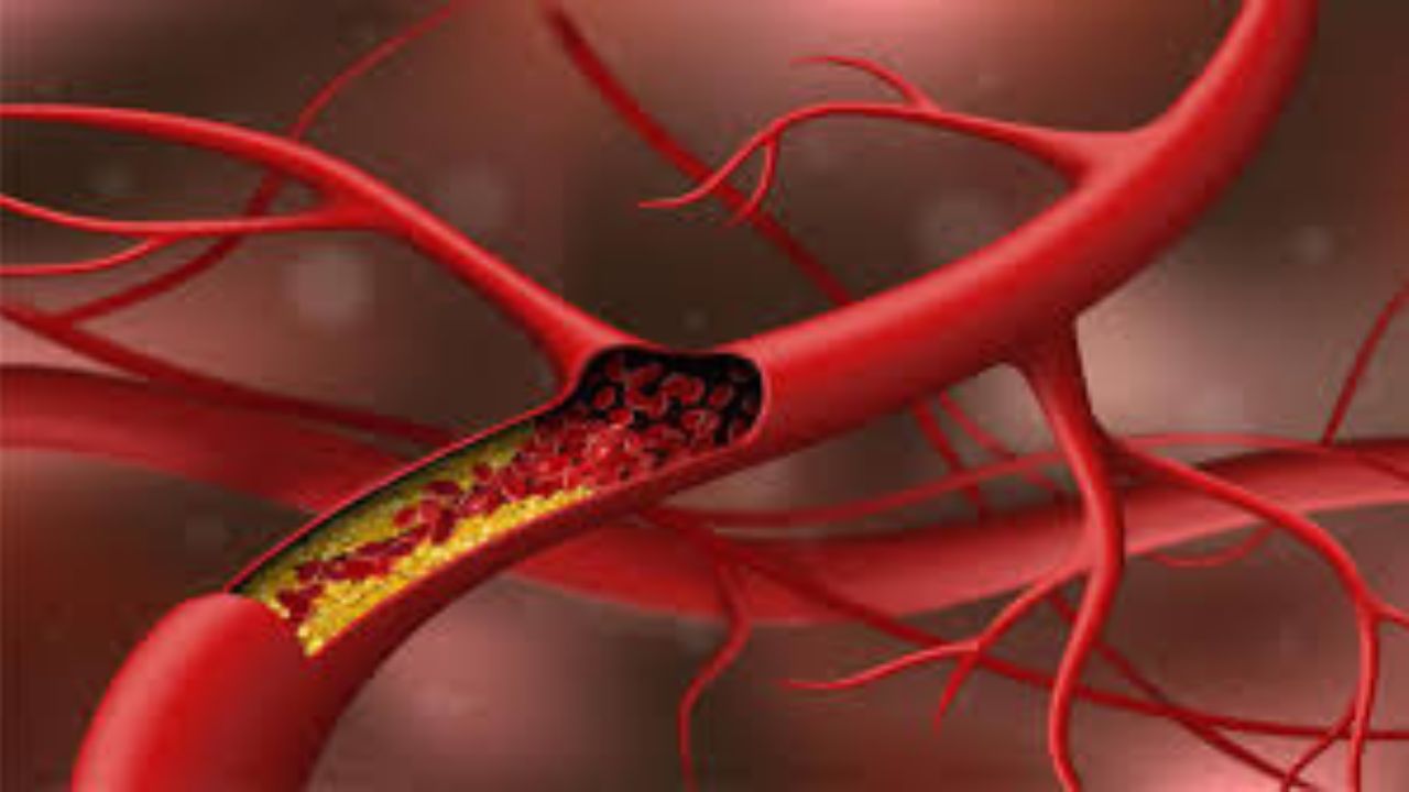 Cholesterol: रक्त वाहिकाओं में जमा होने का सबसे बड़ा संकेत, इसे नजरअंदाज करना पड़ सकता है महंगा